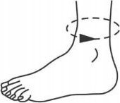 OrthoVisions ORTEZA STAWU SKOKOWEGO STABILIZATOR STOPY I KOSTKI 10