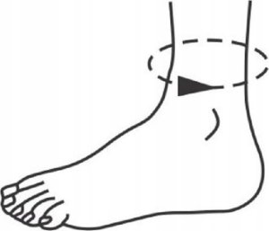 ORTHO VISIONS ORTEZA STAWU SKOKOWEGO STABILIZATOR KOSTKI I STOPY 6