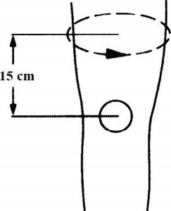 ORTHO VISIONS Stabilizator kolana orteza opaska rzepki fiszbiny 5