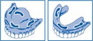 Fittydent Klej Sensitive do protez 40g 9