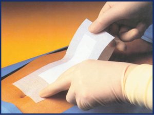 Pharmaplast Pharmapore Sterile-10x10cm Opatrunek samoprzylepny jałowy włókninowy 2