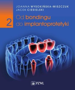 PZWL Od bondingu do implantoprotetyki. Cz. II 1