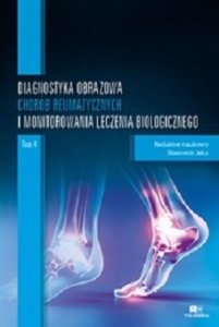 Via Medica Diagnostyka obrazowa chorób reumatycznych i monitorowania leczenia biologicznego. Tom 4 1