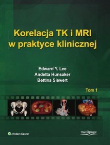 MediPage Korelacja TK i MRI w praktyce klinicznej Tom 1 1