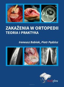 Medisfera Zakażenia w ortopedii. Teoria i praktyka 1