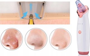 SkinClear ODKURZACZ WĄGRÓW ZASKÓRNIKÓW MIKRODERMABRAZJA 3