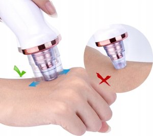 SkinClear ODKURZACZ WĄGRÓW ZASKÓRNIKÓW MIKRODERMABRAZJA 4