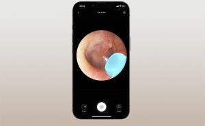 Bebird Otoskop z kamerą do czyszczenia uszu Bebird M9 S (czarny) 4