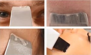 SkinClear PEELING KAWITACYJNY BEZPRZEWODOWY +BONUS 7