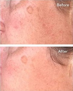 MURAD_Correct And Protect Serum serum do twarzy SPF45 30ml 2