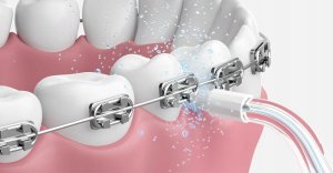 Irygator Oclean A10 Zielony 12