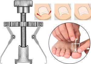 Verk Zestaw do wrastających paznokci u stóp i rąk cążki Zestaw do wrastających paznokci u stóp i rąk cążki 4