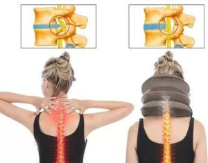 Verk Poduszka do trakcji szyi ortopedyczna trzy poziomy Poduszka do trakcji szyi ortopedyczna trzy poziomy 6