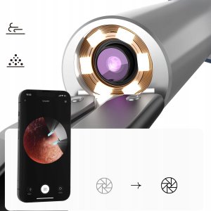 Bebird Otoskop z kamerą do czyszczenia uszu Bebird Note 5 pro (niebieski) 4