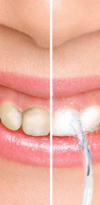 Irygator Home Life Irygator dentystyczny Water Genius bezprzewodowy pomarańczowy 4