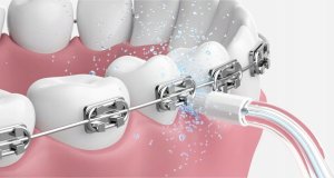 Oclean N20 Standard nozzle for A10 Transparent 4