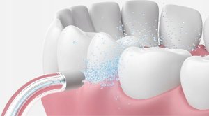 Oclean N20 Standard nozzle for A10 Transparent 5