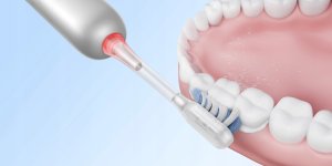 ELECTRIC TOOTHBRUSH/FRESH PRO SILVER ATB15A S MOVA 5