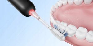 ELECTRIC TOOTHBRUSH/FRESH PRO BLACK ATB15A B MOVA 5