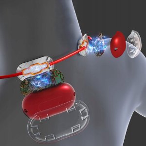 ML Media-Tech Masażer EMS mięśni szyi i karku EMS Neck Massager MT6534 8