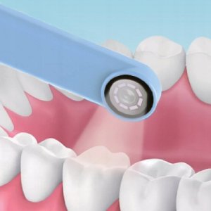 SHONA SZCZOTECZKA SONICZNA DLA DZIECI VISION BLUE 6