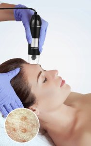 MIKROSKOP CYFROWY USB S4T 14