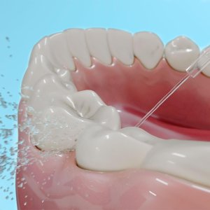 Cecotec ToothCare Jet Fresh Irygator 2