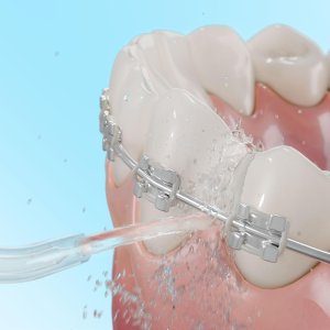 Cecotec ToothCare Jet Fresh Irygator 4