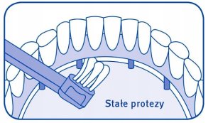 Curaprox CS 708 Implant ortho Szczoteczka 1 sztuka 4