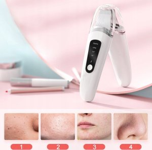 PEELING KAWITACYJNY DO TWARZY 4 TRYBY PRACY JONOFOREZA BEZPRZEWODOWY USB-C 3