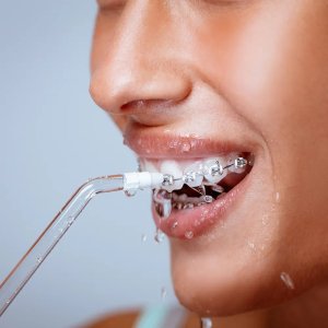 Irygator do zębów Lovio HydroJet PRO 2