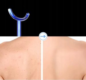 Najmocniejszy Darsonval 7 Pelot - Profesjonalne Urządzenie Kosmetyczne 15