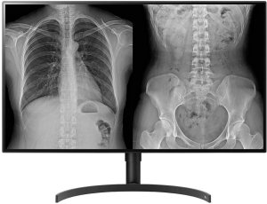 Monitor LG 32HL512D-B 1