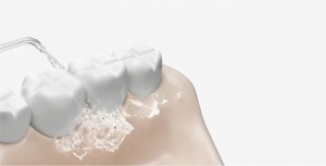 Irygator Xiaomi Water Flosser 2 (AGDXAOIRY0004) 3