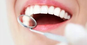 APACARE PASTA DO ZĘBÓW OraLactin 75ml 2