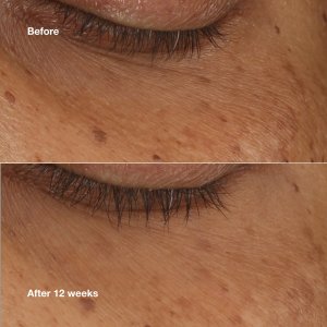 CLINIQUE_All About Eyes Brightening serum serum pod oczy 10ml 2