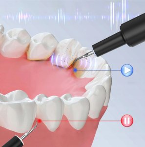 SKALER STOMATOLOGICZNY ULTRADŹWIĘKOWY DO ZĘBÓW - 4 TRYBY, MOCNY BRADERS 2