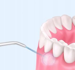 PROFESJONALNY DENTYSTYCZNY IRYGATOR DO ZĘBÓW BEZPRZEWODOWY MOCNY - 5 DYSZ 9