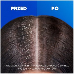 head & shoulders Head&Shoulders Deep Hydration Szampon Do Włosów Coconut 400ml 5
