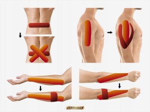 Capsicolle Taśma kinezjologiczna (5m) z naturalną kapsaicyną, EAN 8594069332919 2