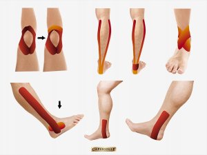 Capsicolle Taśma kinezjologiczna (5m) z naturalną kapsaicyną, EAN 8594069332919 3