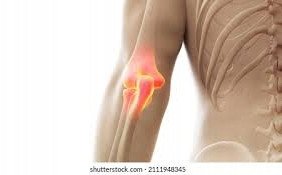 Orteza Usztywniacz Stabilizator Łokieć 2Szt Xl 8