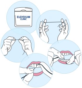 Elgydium OTC ELGYDIUM NIĆ CLINIC CROSSING FLOSS 2