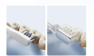 Laifen Szczoteczka do Zębów Soniczna Wave ABS Mleczna 3 Głowki Aplikacja 10