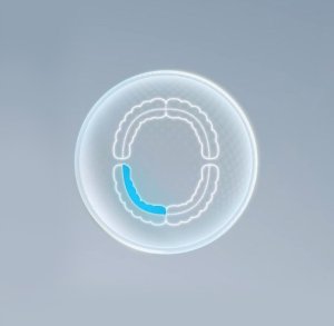 Szczoteczka Oclean X Ultra 20 Zielona 8