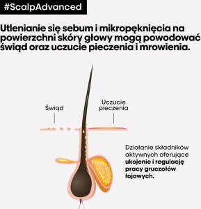 Plaukų šampūnas jautriai galvos odai L'oreal Professionnel Serie Expert Scalp Advanced Anti-Discomfort Dermo-Regulator, 300 ml 5