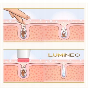 LUMINEO Professional Line Szczoteczka do twarzy Brush Pro różowa + Żel oczyszczajacy Lumineo do skóry wrażliwej 100 ml 10