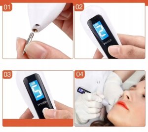 LASER PEN PLAZMA USUWANIE TATUAŻU BLIZN BRODAWEK 2