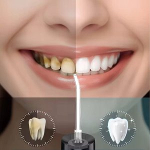 Irygator Przenośny Bezprzewodowy Dentystyczny do Zębów Jamy Ustnej 500 ml 4