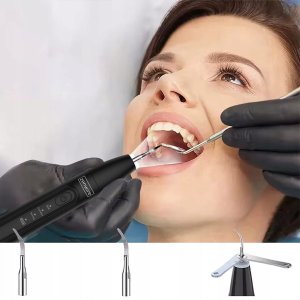 Skaler Ultradźwiękowy do Zębów Usuwania Kamienia Nazębnego Dentystyczny LED 3